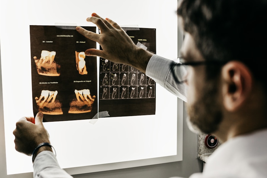 Medical Report Analyzer